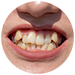 braces treatment BTM Layout 1st Stage