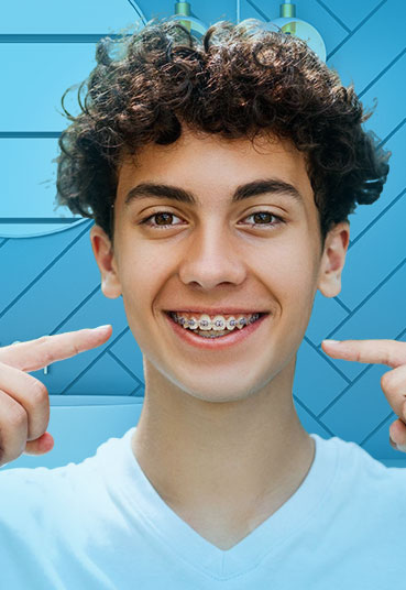 Braces Treatment in BTM Layout 1st Stage